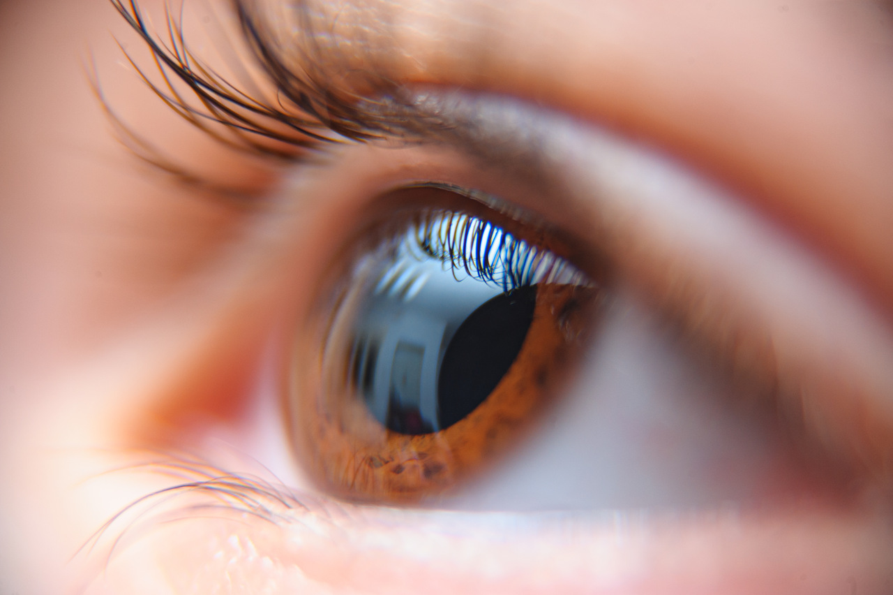LASIK ou PRK: qual é a diferença e como saber qual é para mim?